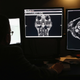Illustration for article titled Anyone Can Look at Millions of Americans' Medical Images and Data, Report Finds